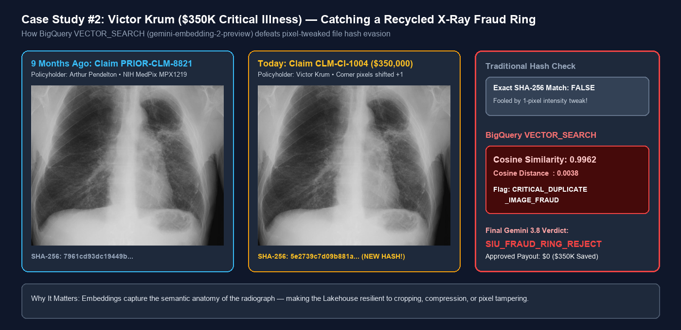 Case Study #2: Victor Krum ($350K Critical Illness) — Catching a Recycled X-Ray Fraud Ring
